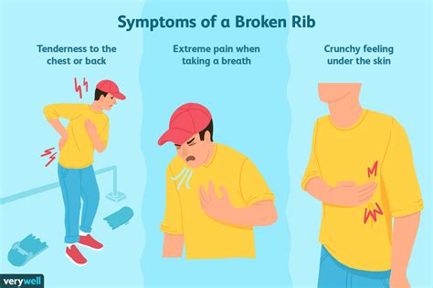 Don't Ignore the Pain: Recognizing the Signs and Symptoms of Bruised Ribs